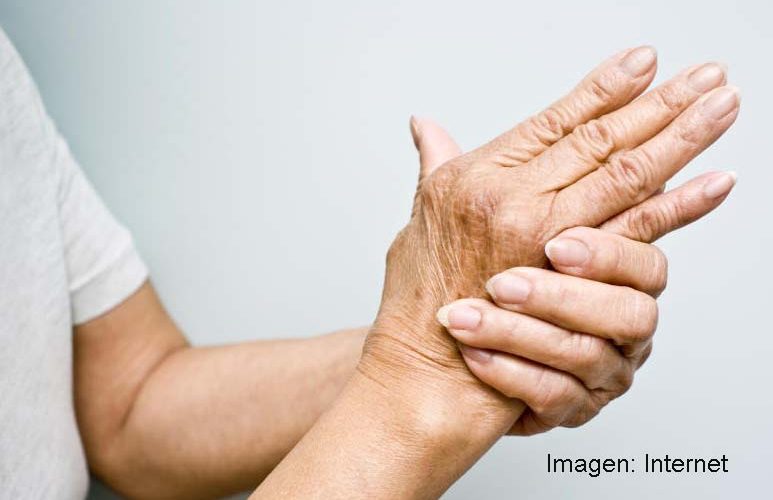 Dolor o inflamación articular constante pueden ser síntomas de artritis reumatoide